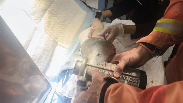 جراحت شدید دست زن کارگر در چرخ‌گوشت در مرکز تهران