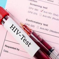 راه‌اندازی شبکه تحقیقات و فناوری HIV
