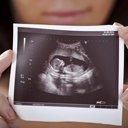 حواشی اختلاف قدیمی درباره قانون جمعیت تازه شد/ وحید دستجردی: غربالگری ممنوع نیست اما پوشش بیمه ندارد