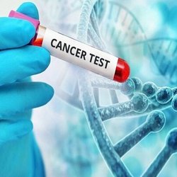 برنامه غربالگری ۳ سرطان شایع در کشور